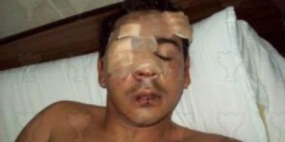 EN UN KIOSCO DE GOYA Jóvenes brutalmente golpeados acusan a voluntarios del ejército